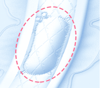 ソフィ&reg;センターイン