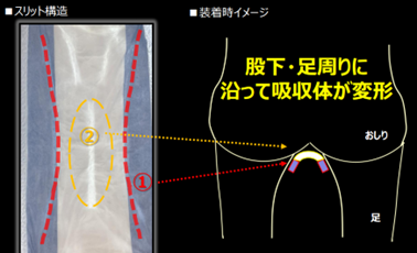 ソフィ&reg;センターイン